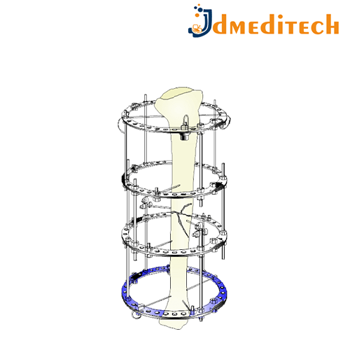 External Fixators jdmeditech