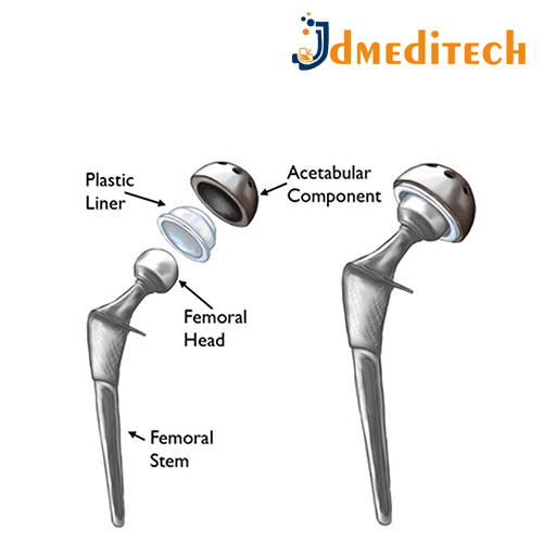 Hip Implants jdmeditech