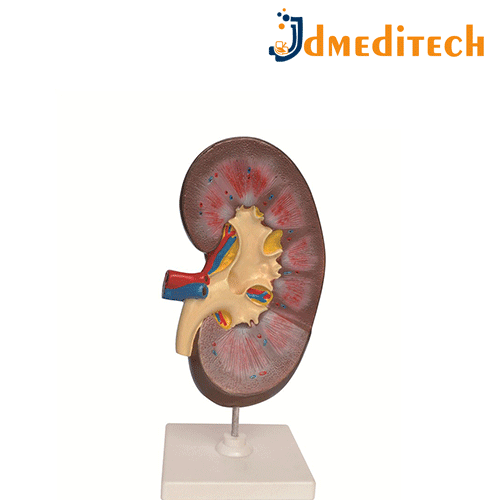 Human Kidney Model jdmeditech