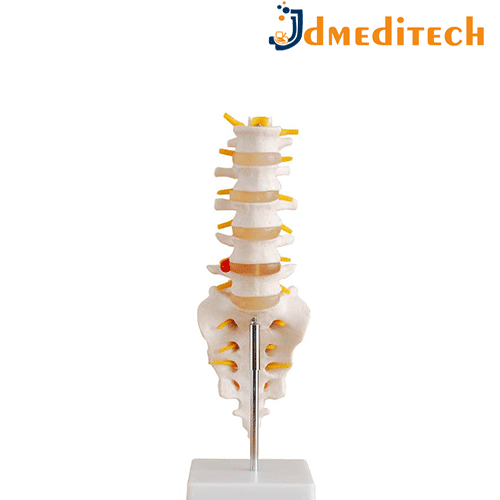 Human Lumbar Model jdmeditech