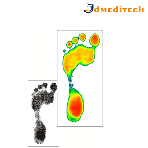 Simple Plantar Pressure System jdmeditech