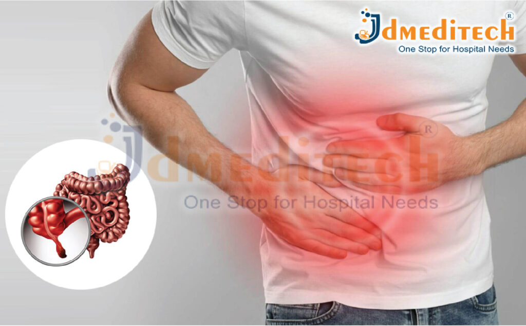 Appendectomy Surgery