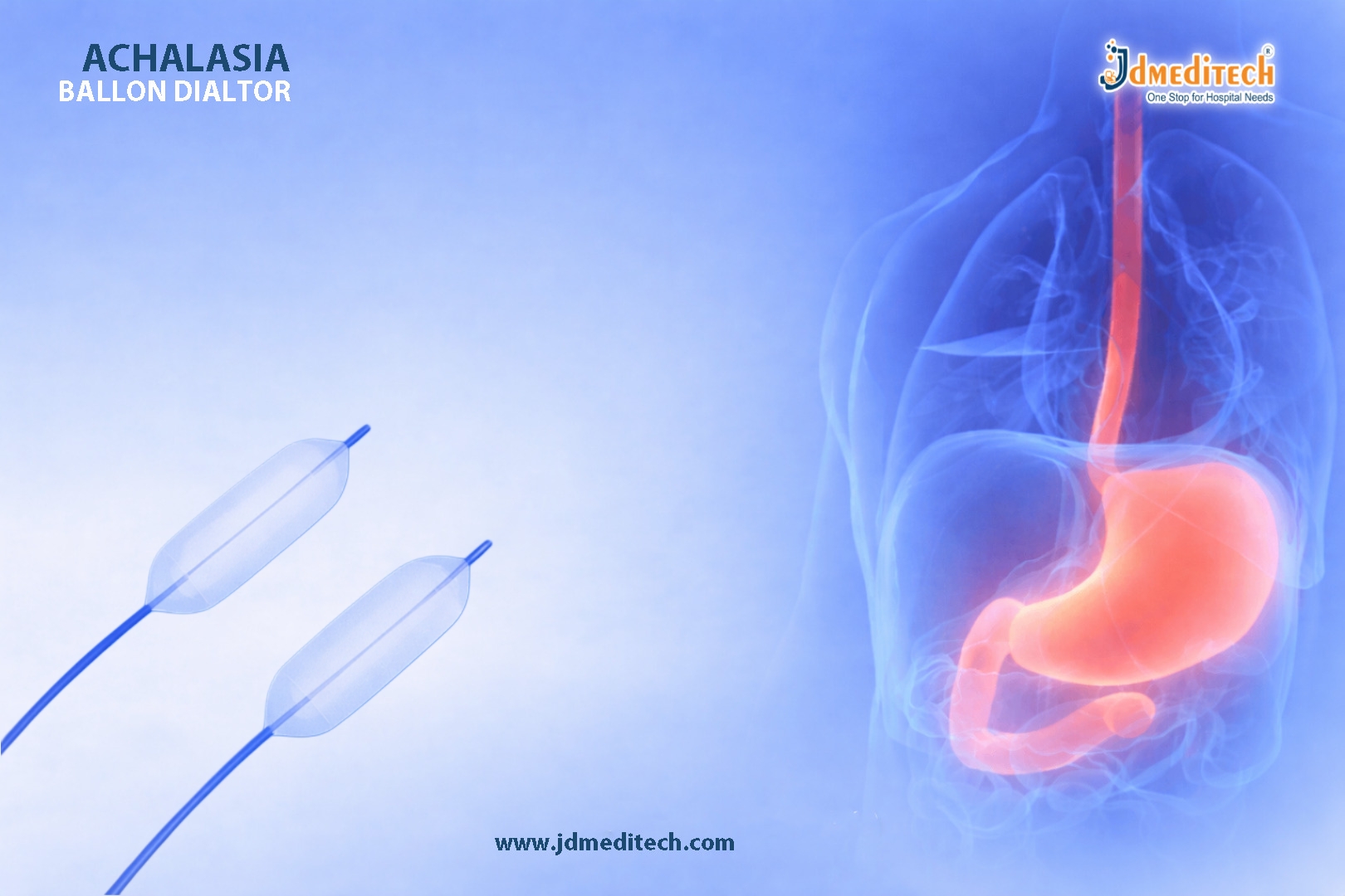 Achalasia Balloon Dilator – Safe & Effective Non-Surgical Esophageal Treatment