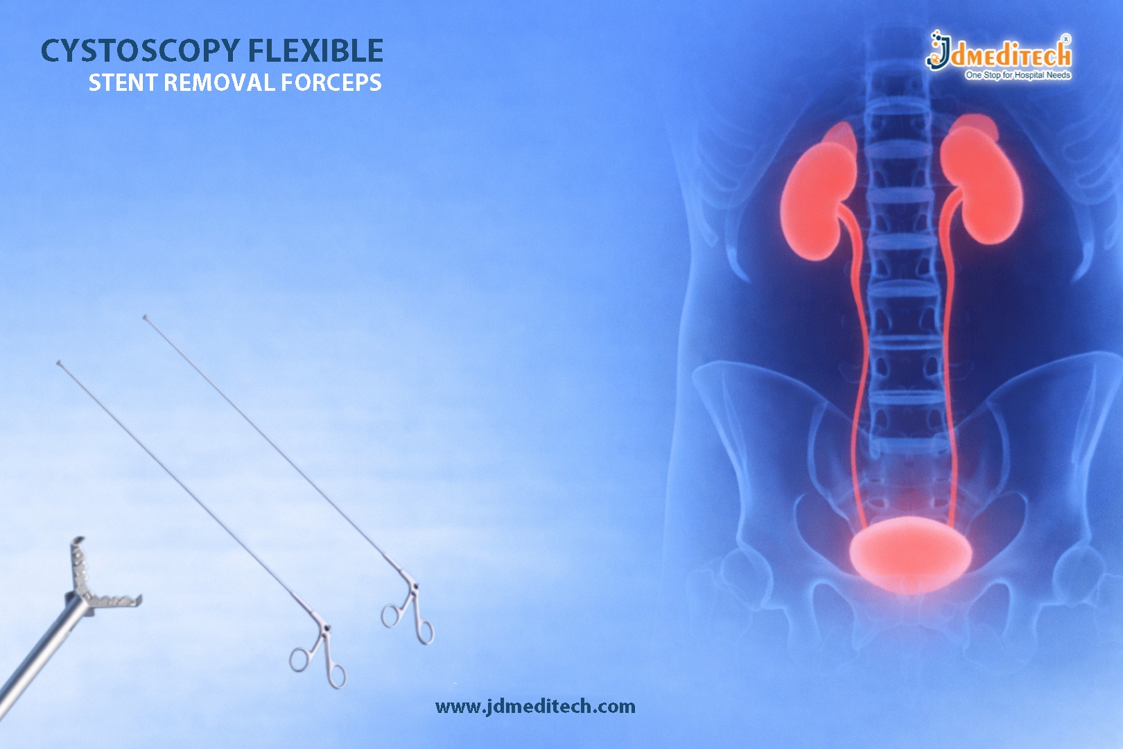Cystoscopy Flexible Stent Removal Forceps – Precision Tools for Cystoscopic Retrieval