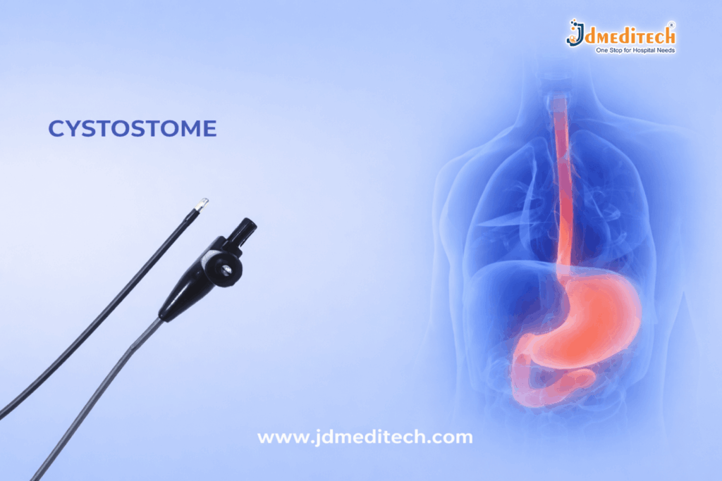 Cystostome Endoscopic Tool – Uses, Benefits & Key Features Explained