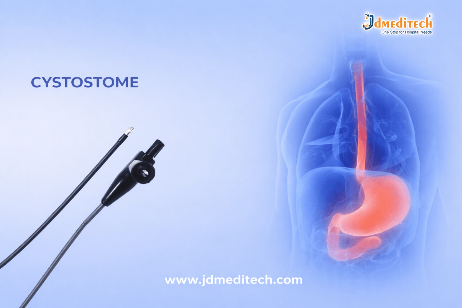 Cystostome Endoscopic Tool – Uses, Benefits & Key Features Explained
