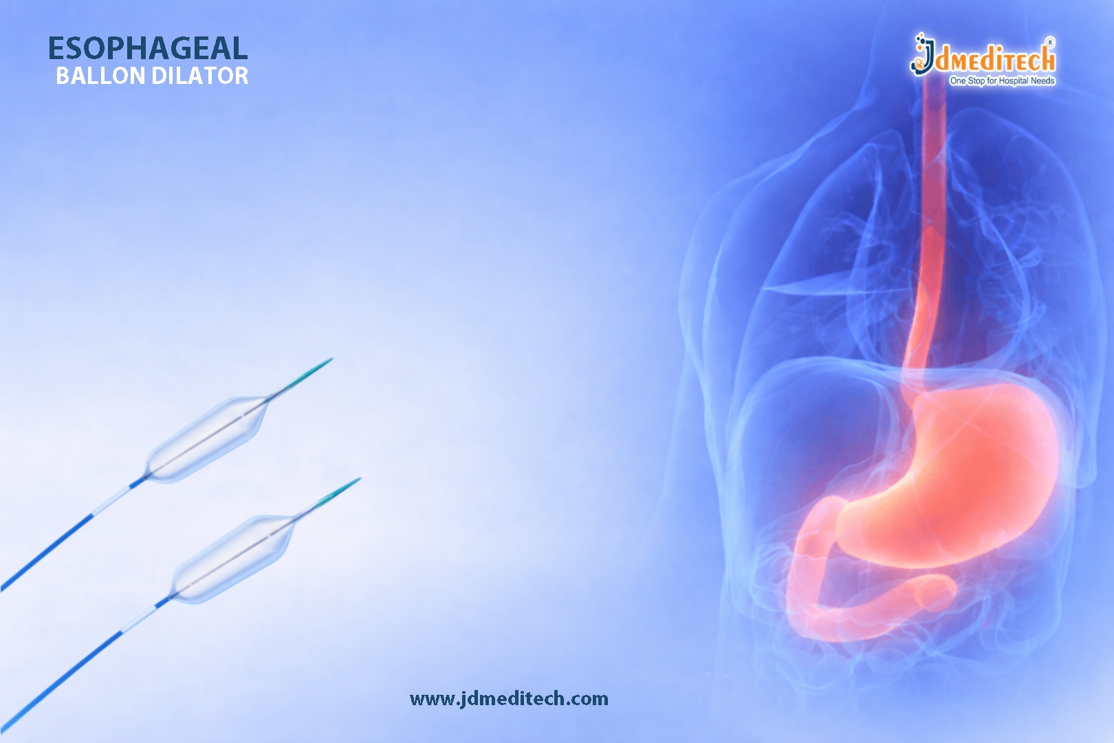 Esophageal Balloon Dilator: Uses, Procedure & Benefits