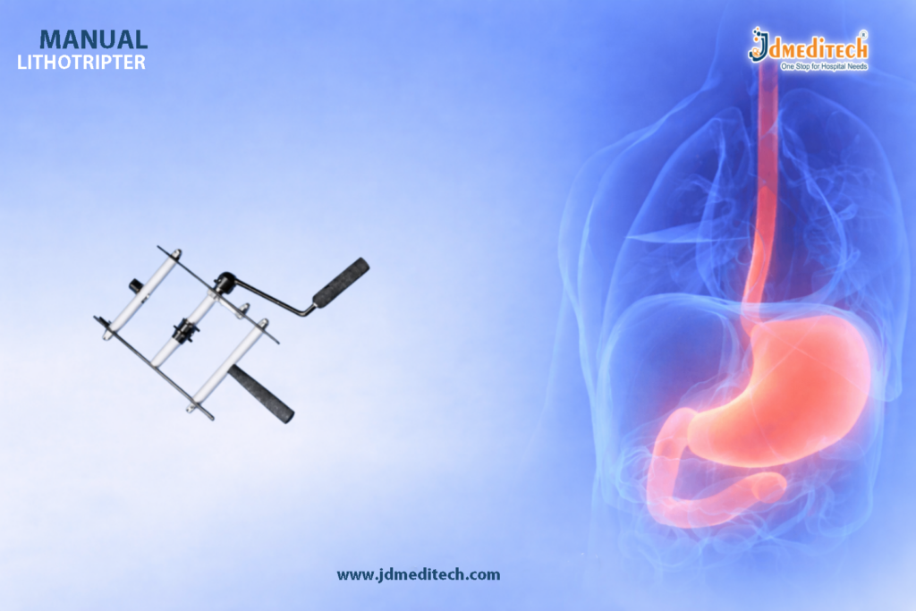 Manual Lithotripters in Gastroenterology – Safe & Effective Stone Removal