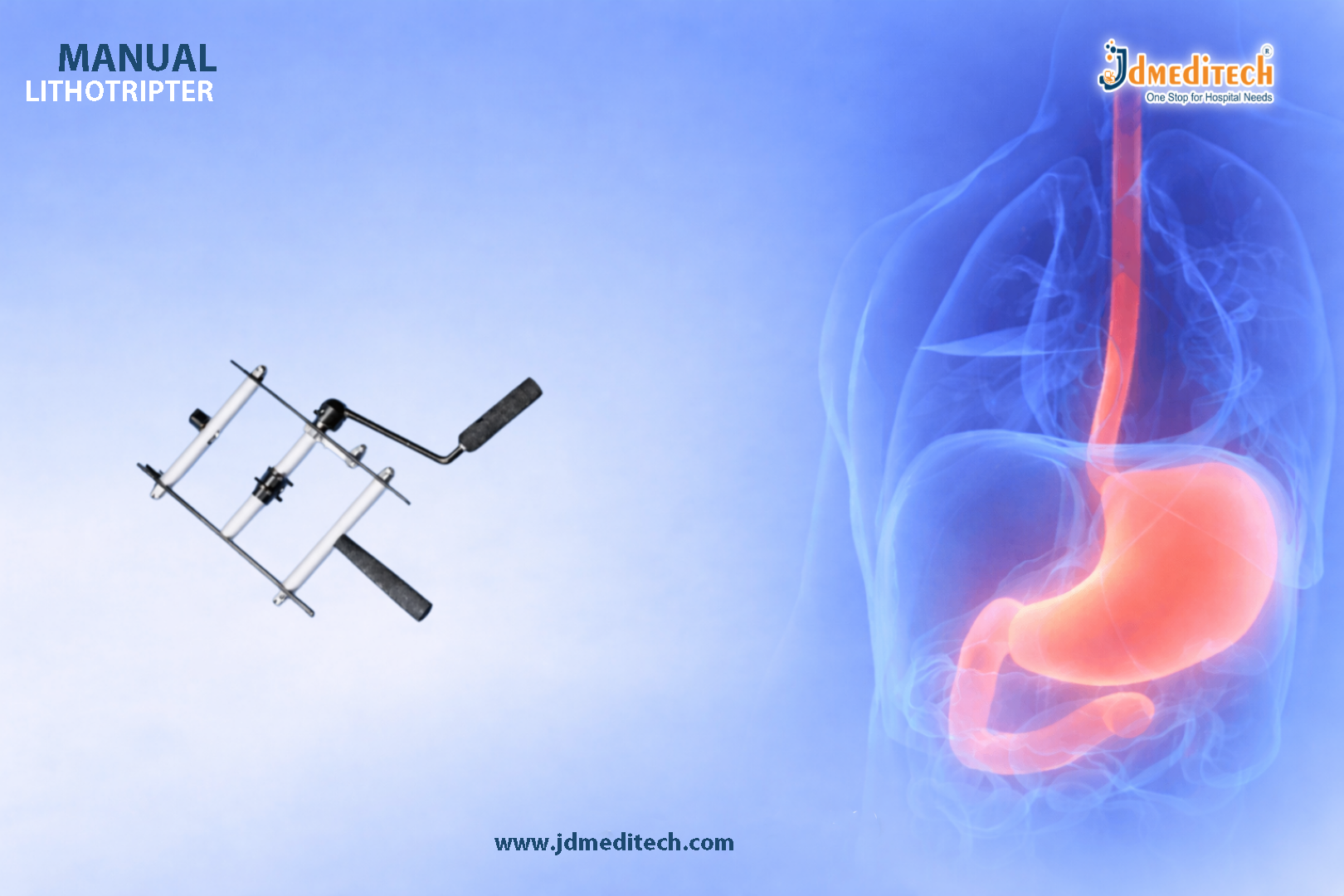 Manual Lithotripters in Gastroenterology – Safe & Effective Stone Removal