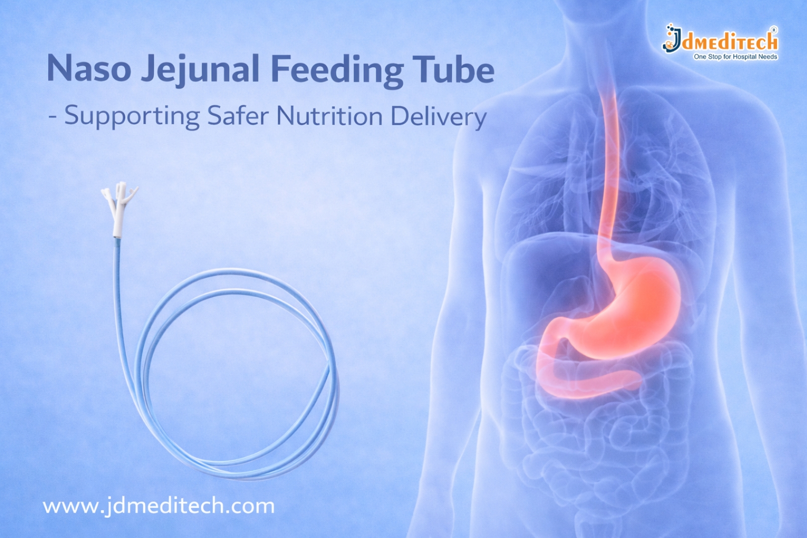 Struggling with Enteral Feeding? Try Naso Jejunal Feeding Tube