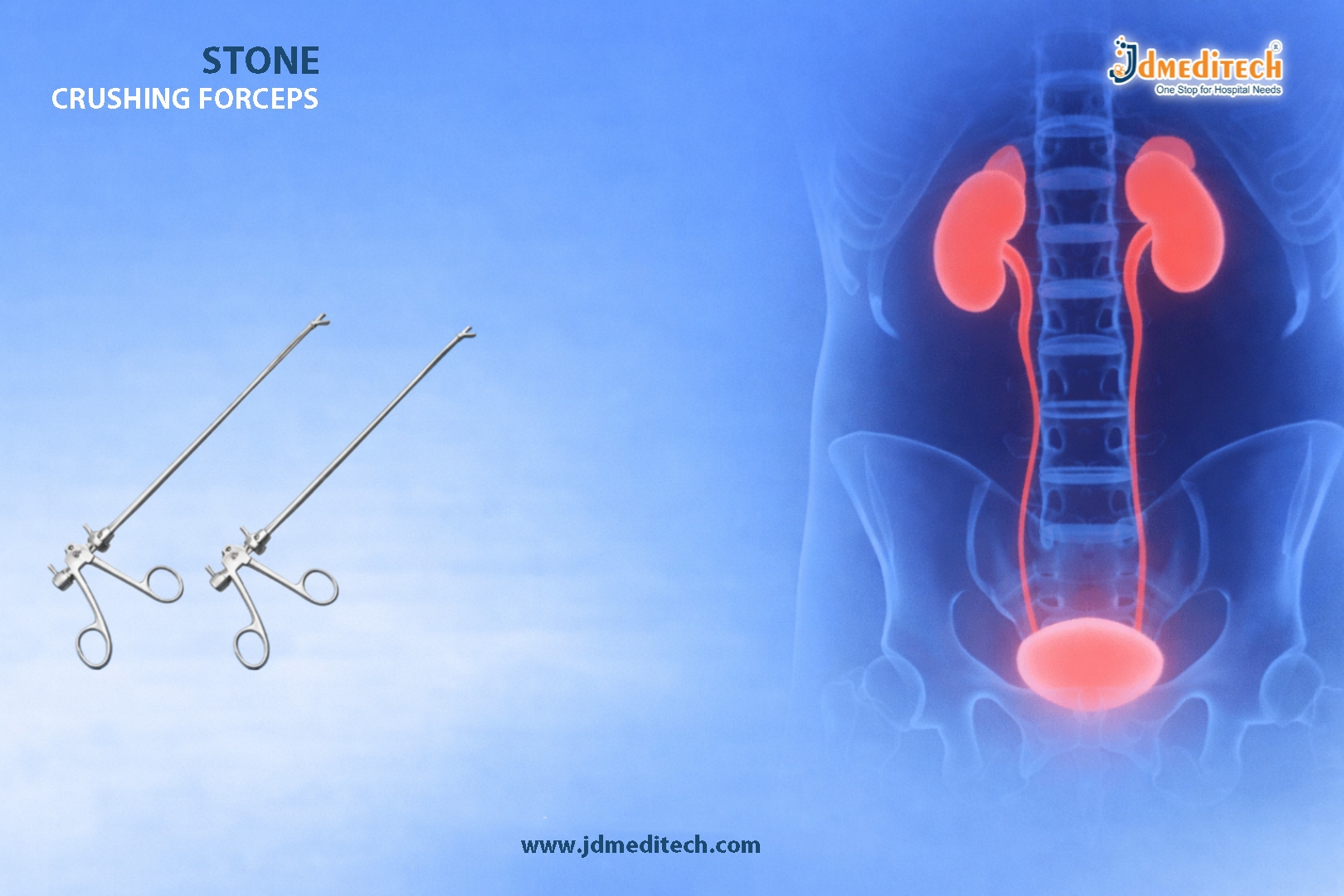 Stone Crushing Forceps for Bladder Stone Removal – Precision Urology Instrument