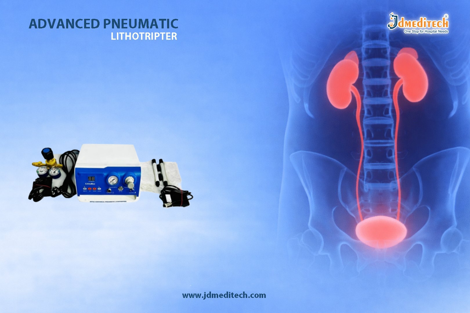 Litho+ Pneumatic Lithotripter for Stone Management
