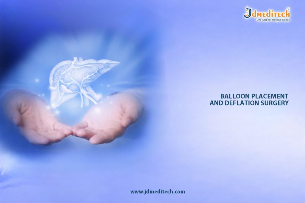 Balloon Placement & Deflation for Safe Stomach Balloon Therapy