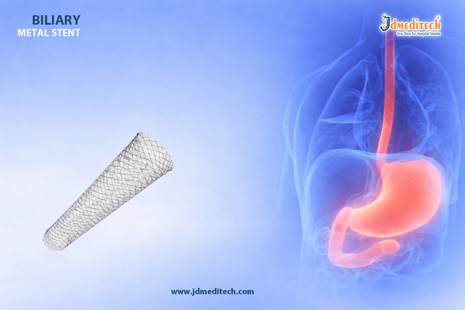 Biliary Metal Stent for Long-Term Bile Duct Patency