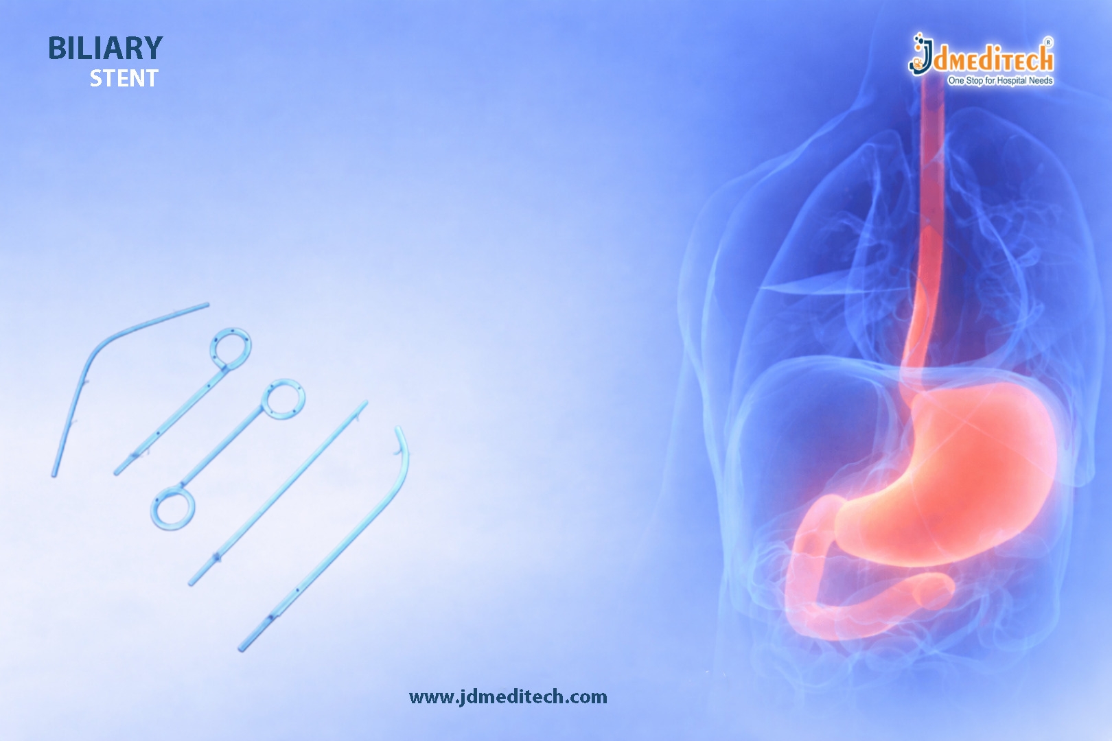Biliary Stents: Advanced Solution for Bile Duct Obstruction