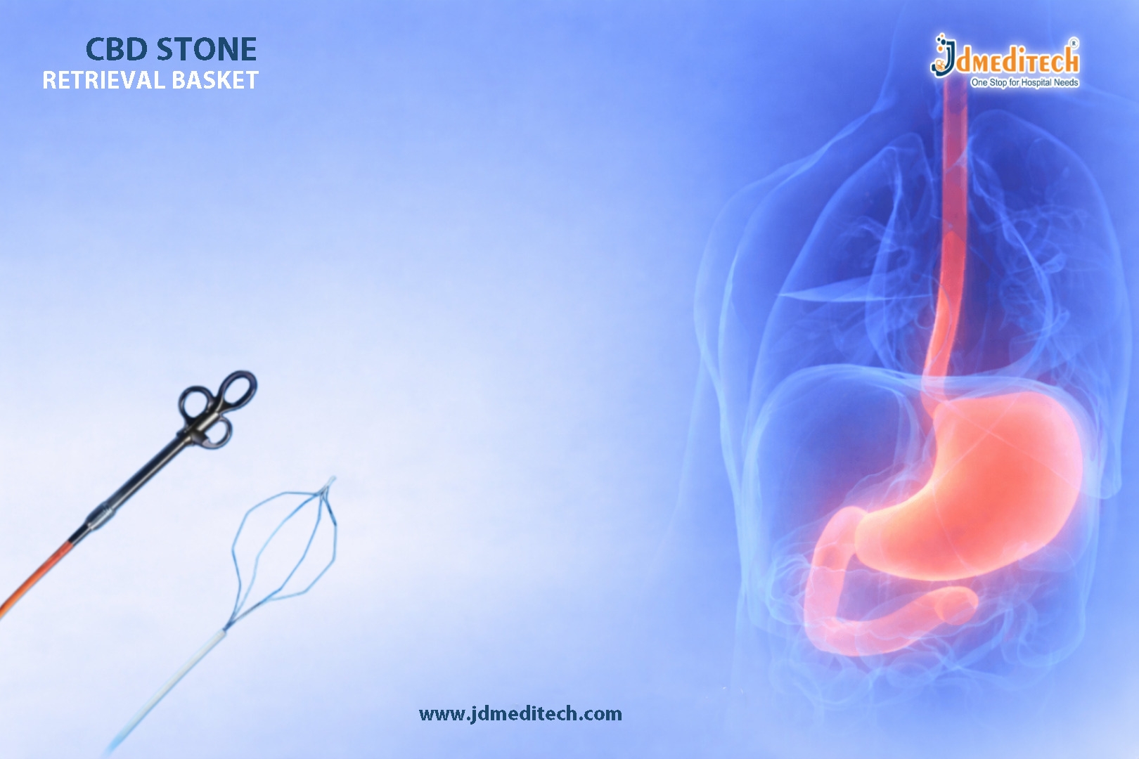 CBD Stone Retrieval Basket for Effective Bile Duct Clearance