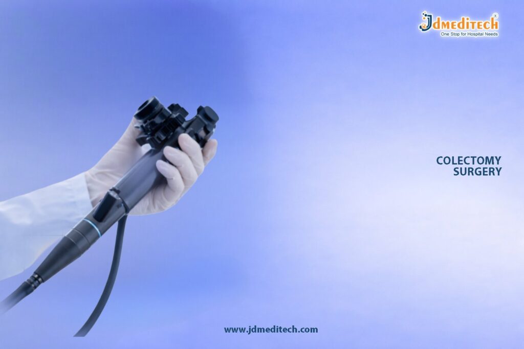Colectomy Surgery – Safe Colon Removal Guide