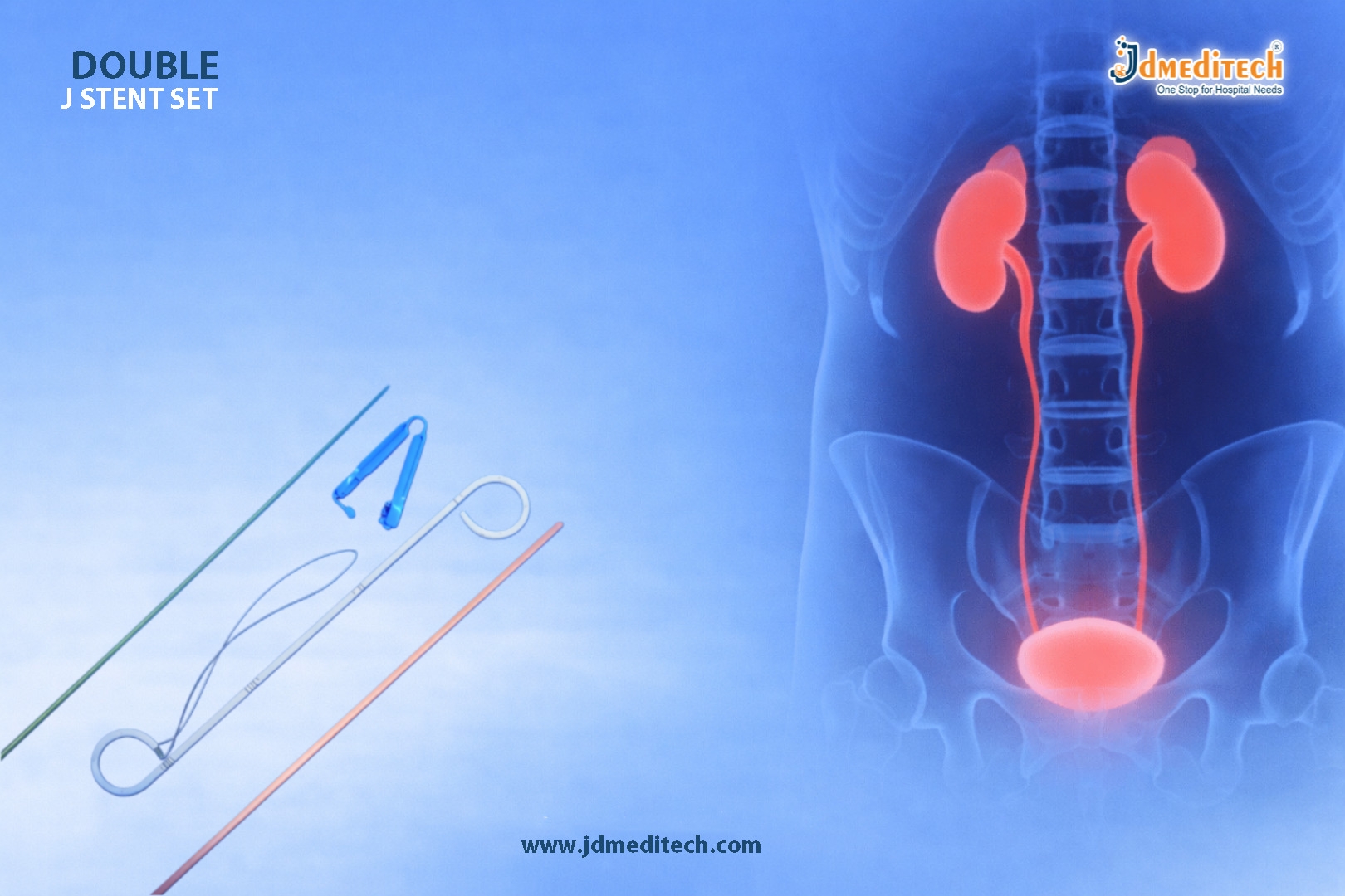 Double J Stent Set for Ureteral Drainage | Reliable Urology Solution