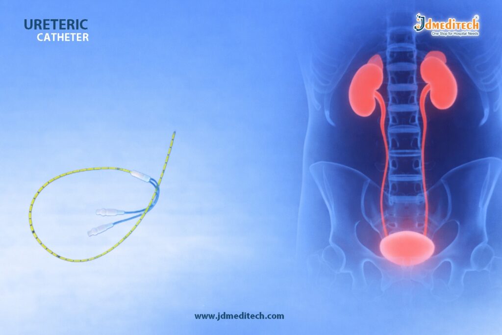 Dual Lumen Catheter for Advanced Urological Care