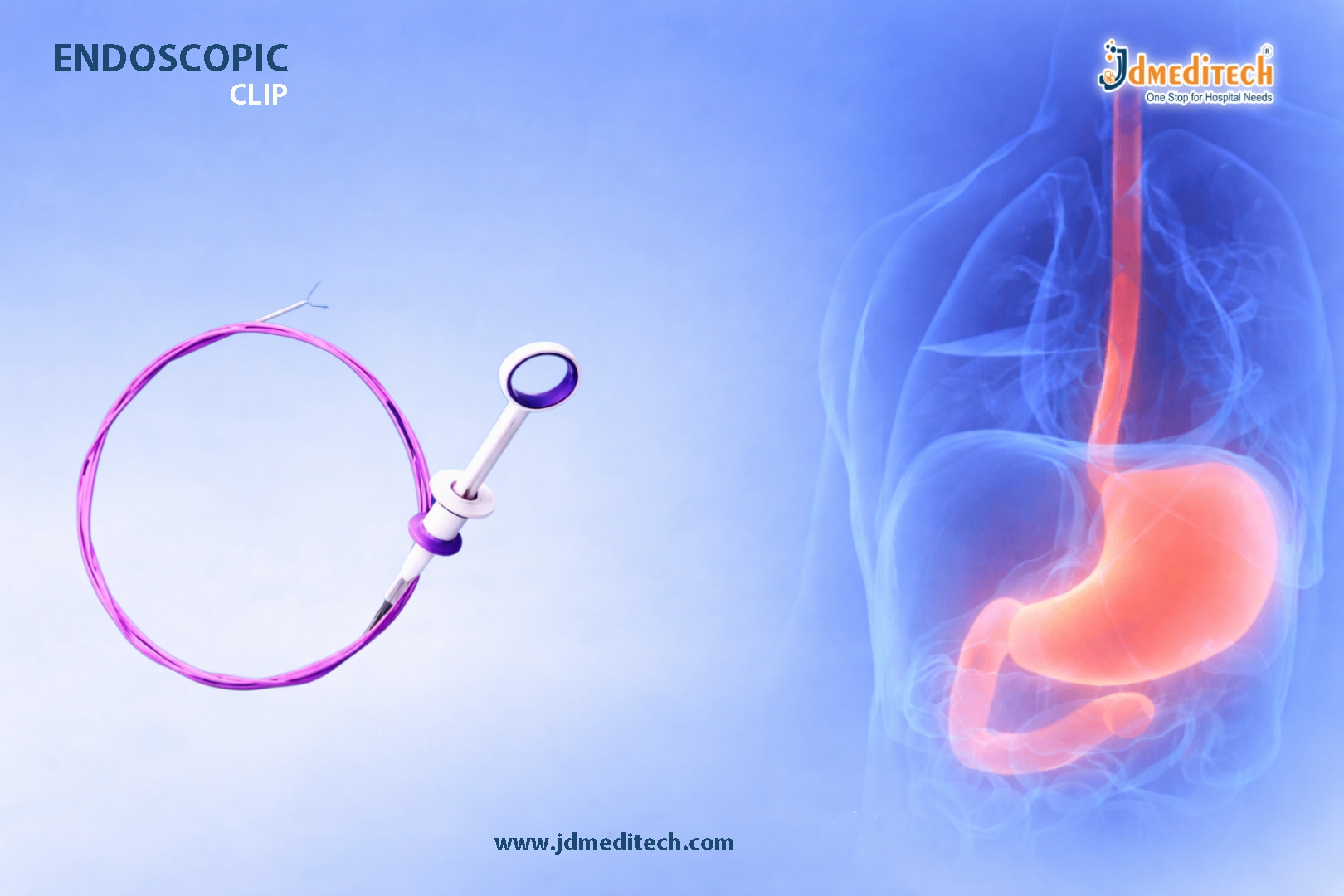 Endoscopic Clip for GI Procedures | Advanced Clipping Solutions