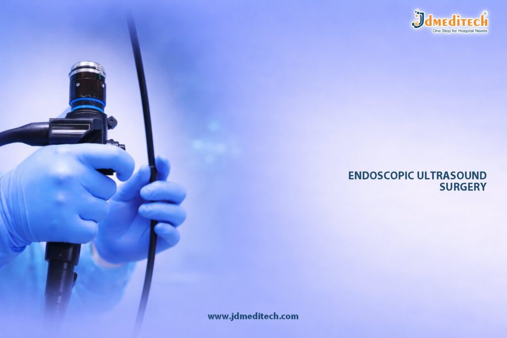 Endoscopic Ultrasound for GI Evaluation