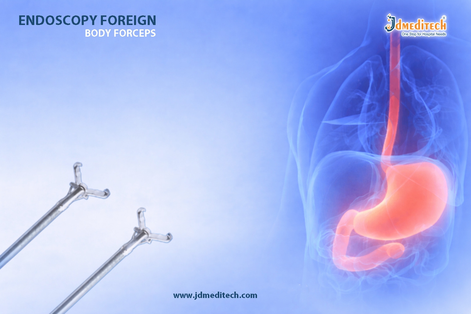 Endoscopy Foreign Body Forceps for Safe Retrieval