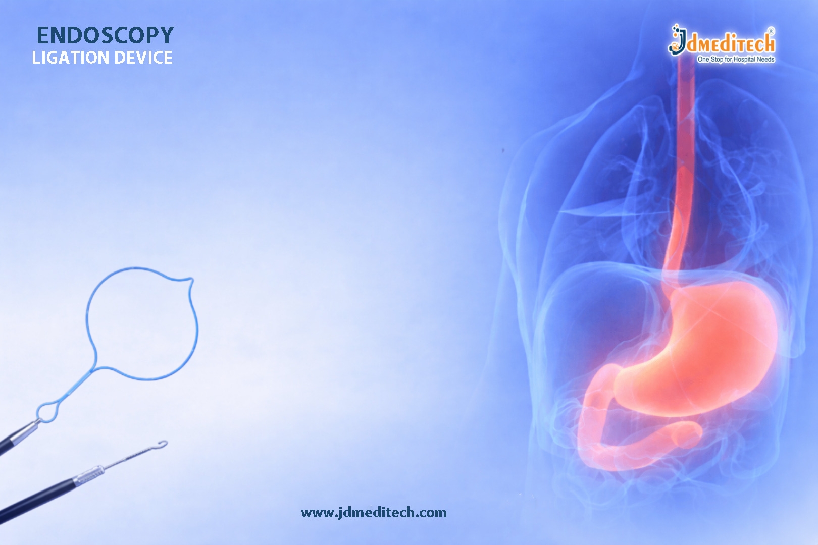 Endoscopy Ligation Device for Variceal Hemostasis | Complete Guide