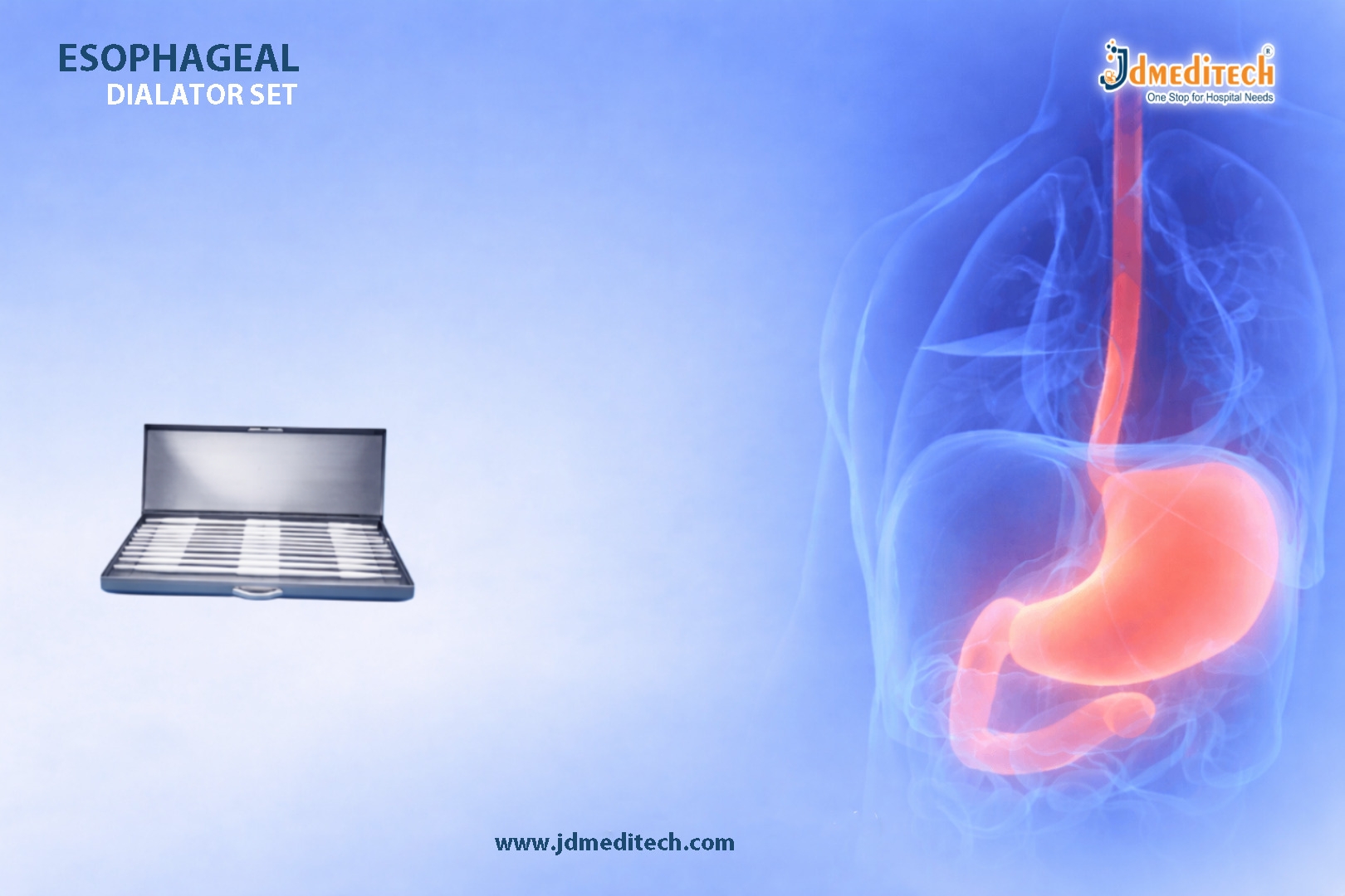 Esophageal Dilator Set for Safe Dysphagia Treatment