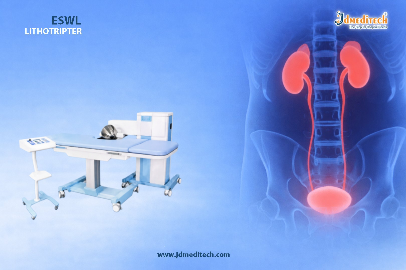ESWL Lithotripter – Non-Invasive Kidney Stone Treatment