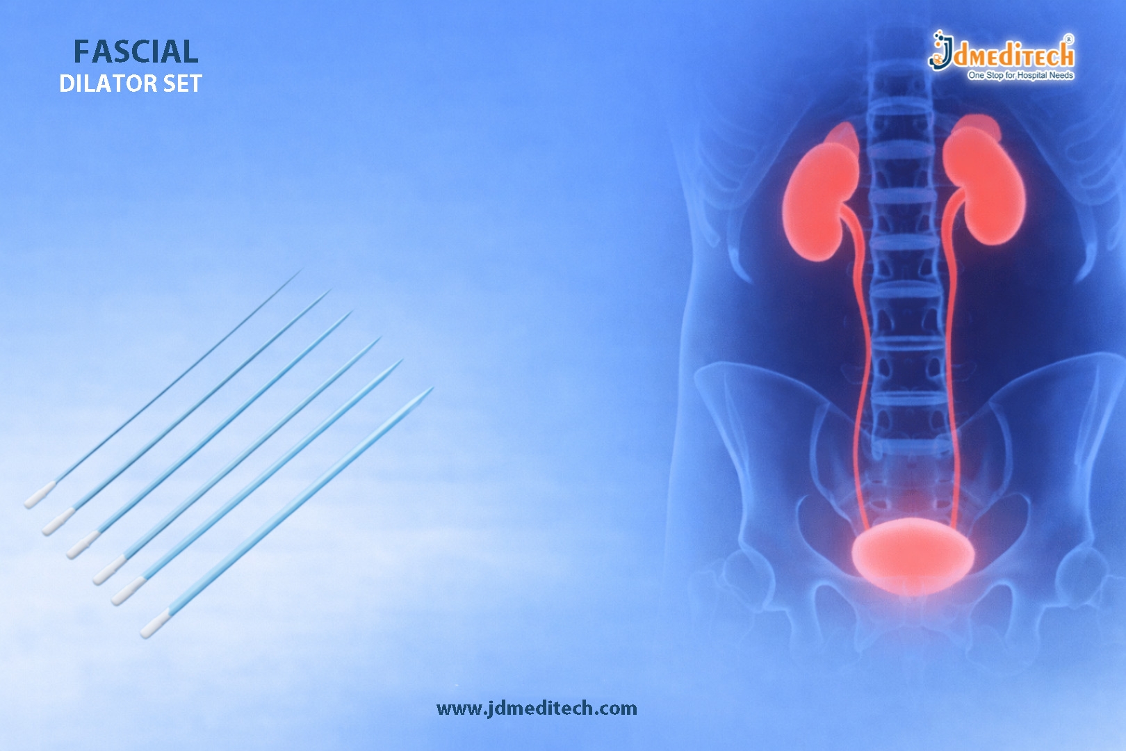 Fascial Dilator Set for Safe Percutaneous Tract Formation