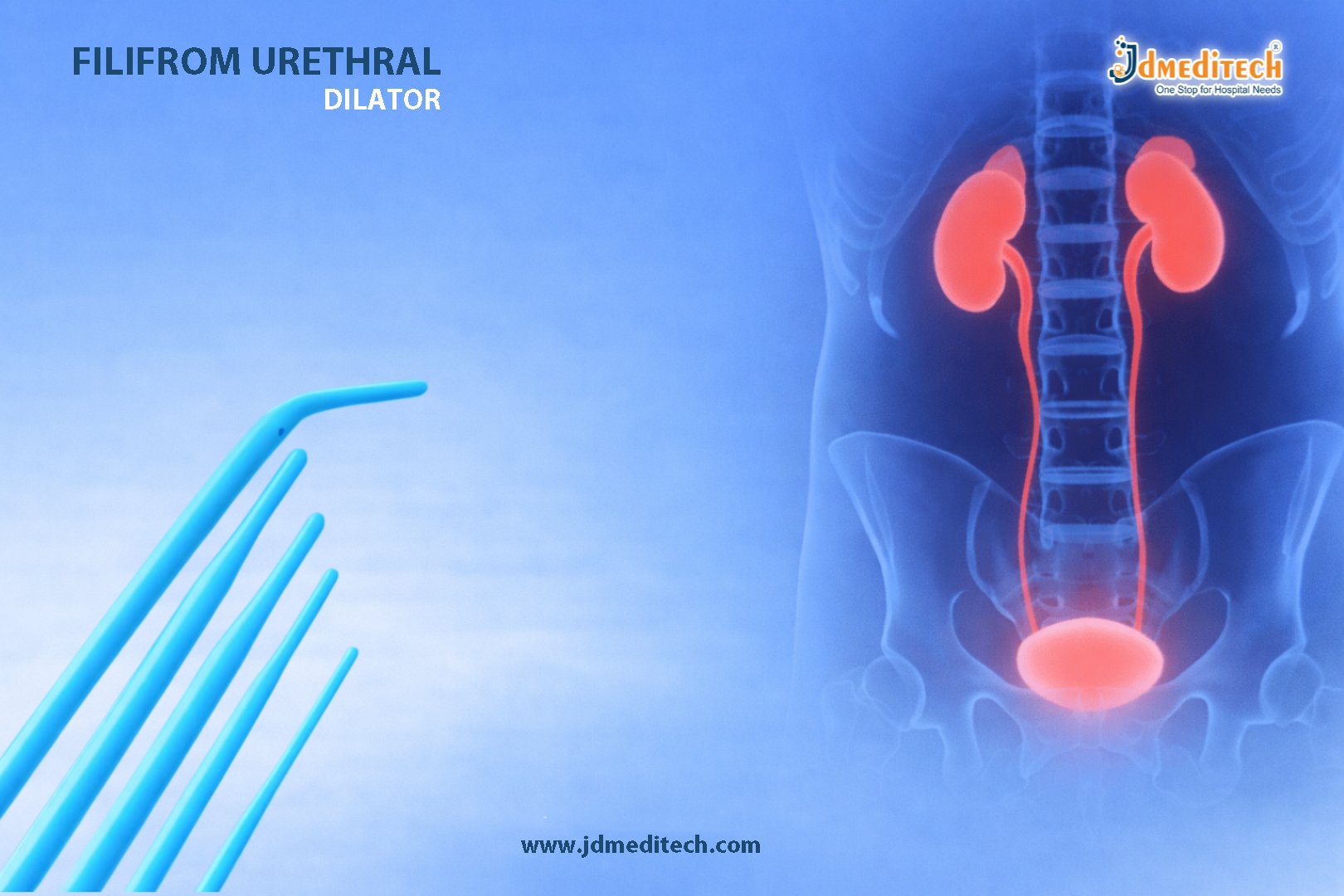 Filiform Urethral Dilator for Urethral Strictures | Safe Urology Tool