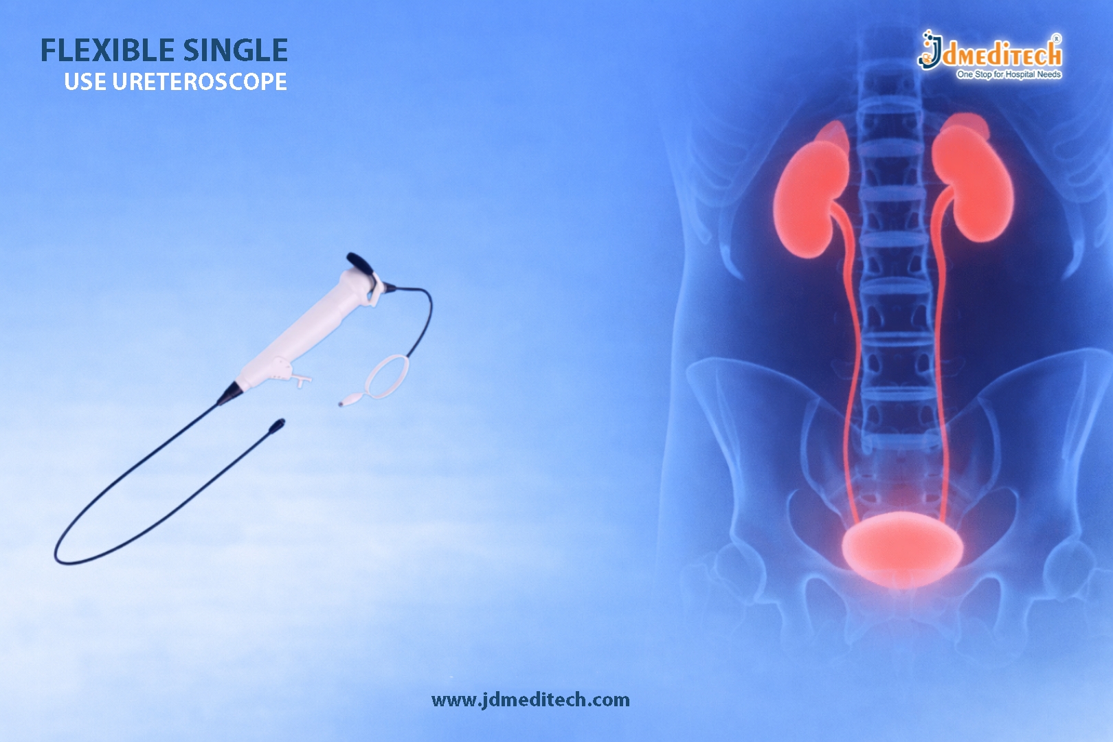 Flexible Single Use Ureteroscope – Hassle-Free Flexibility for Safe Urology Procedures