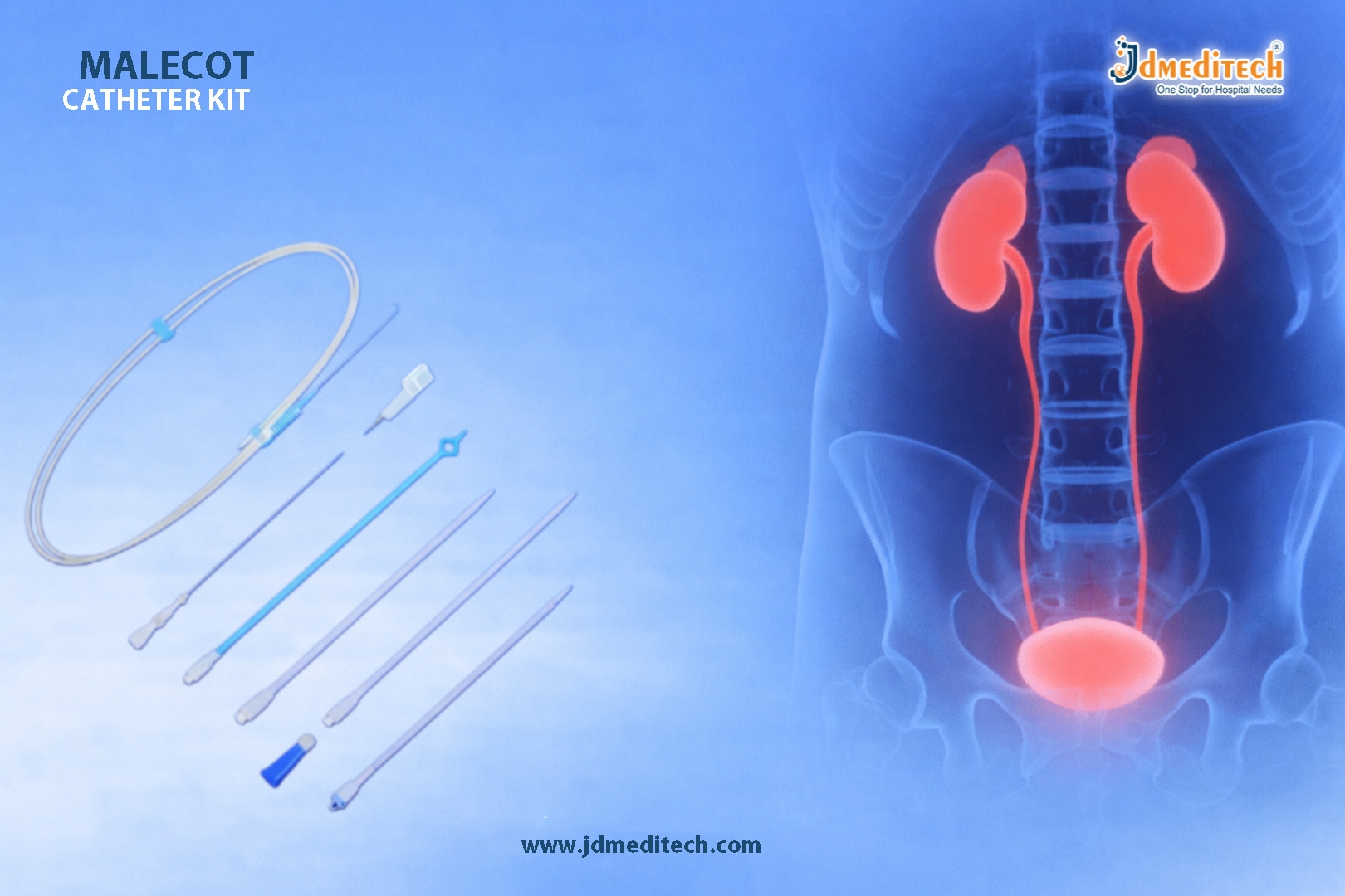 Malecot Catheter Kit for Safe Nephrostomy Drainage
