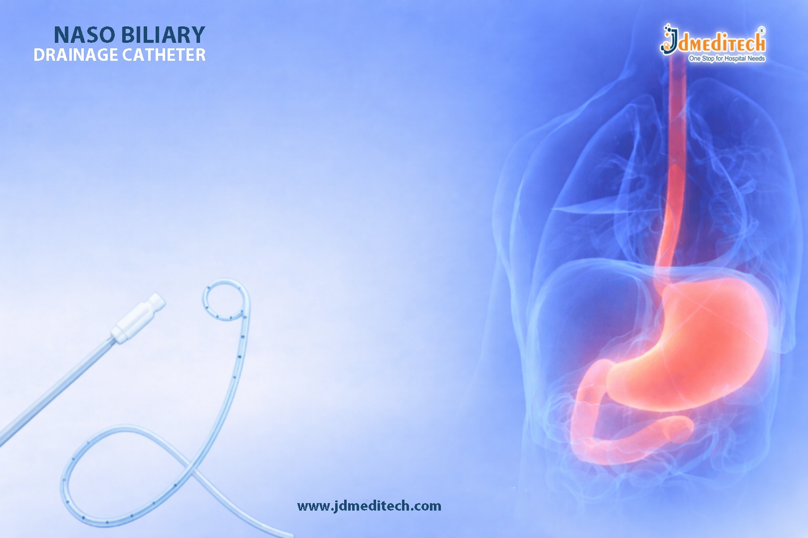 Naso Biliary Drainage Catheter for Biliary Obstruction Treatment