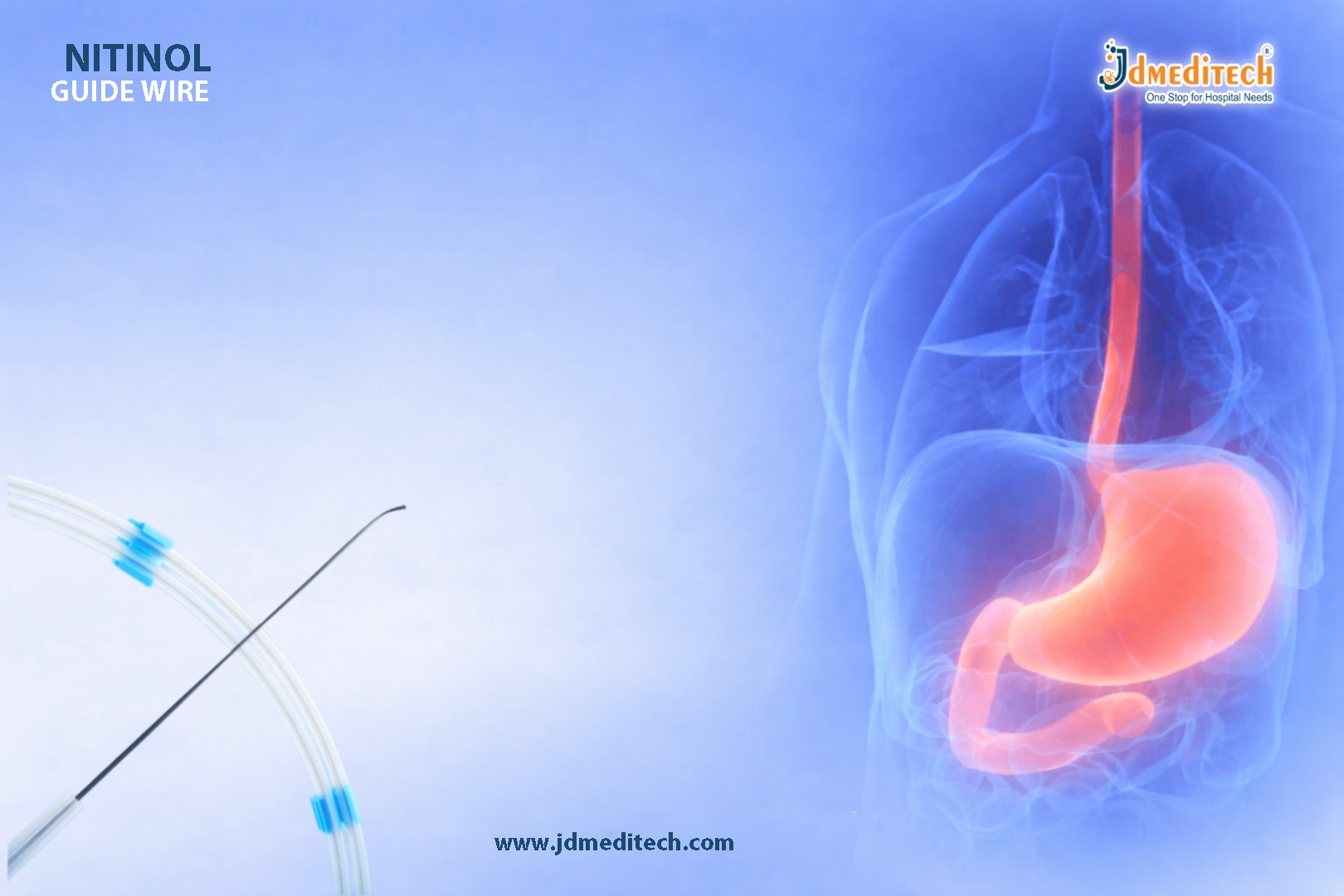 Nitinol Guide Wires in Endoscopy – Precision GI Access Tool