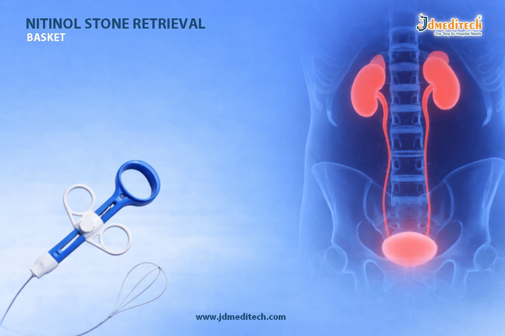 Nitinol Stone Retrieval Basket for Safe Stone Removal