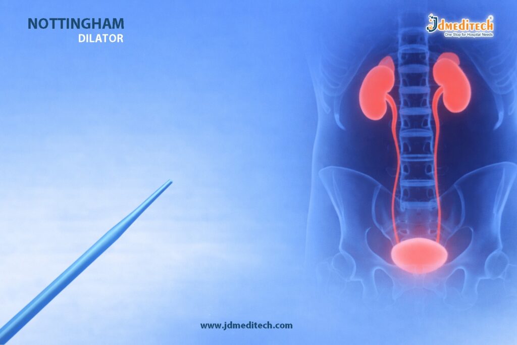 Nottingham Dilator – Progressive Urethral Dilation Tool