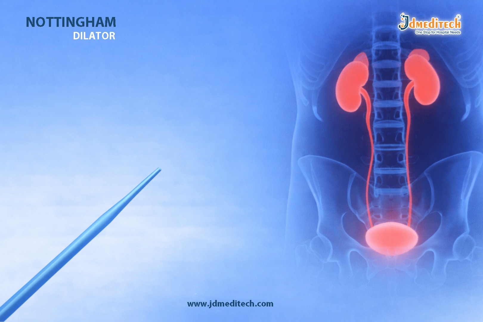 Nottingham Dilator – Progressive Urethral Dilation Tool