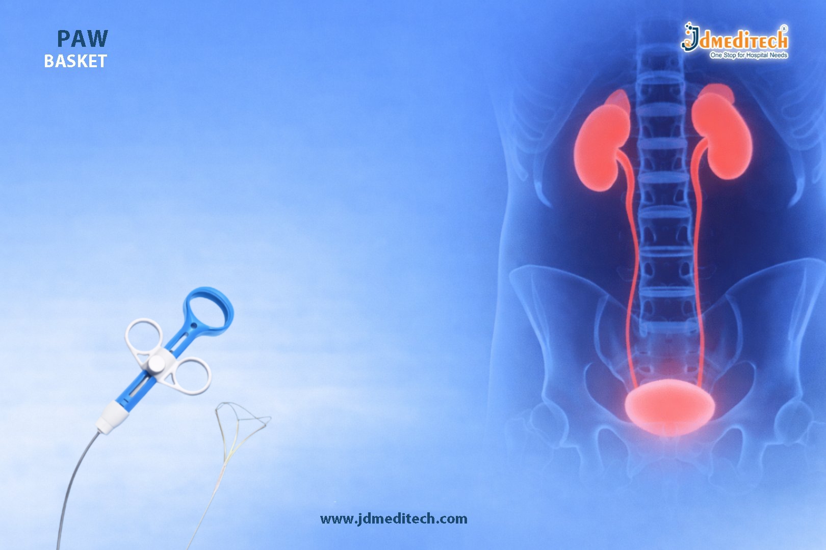 Paw Basket Retrieval – Efficient Stone Removal in Urology