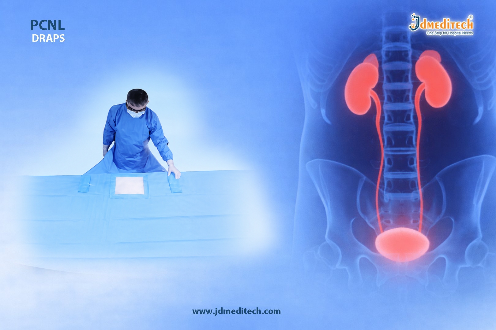 PCNL Drape for Percutaneous Nephrolithotomy | Sterile Surgical Drape