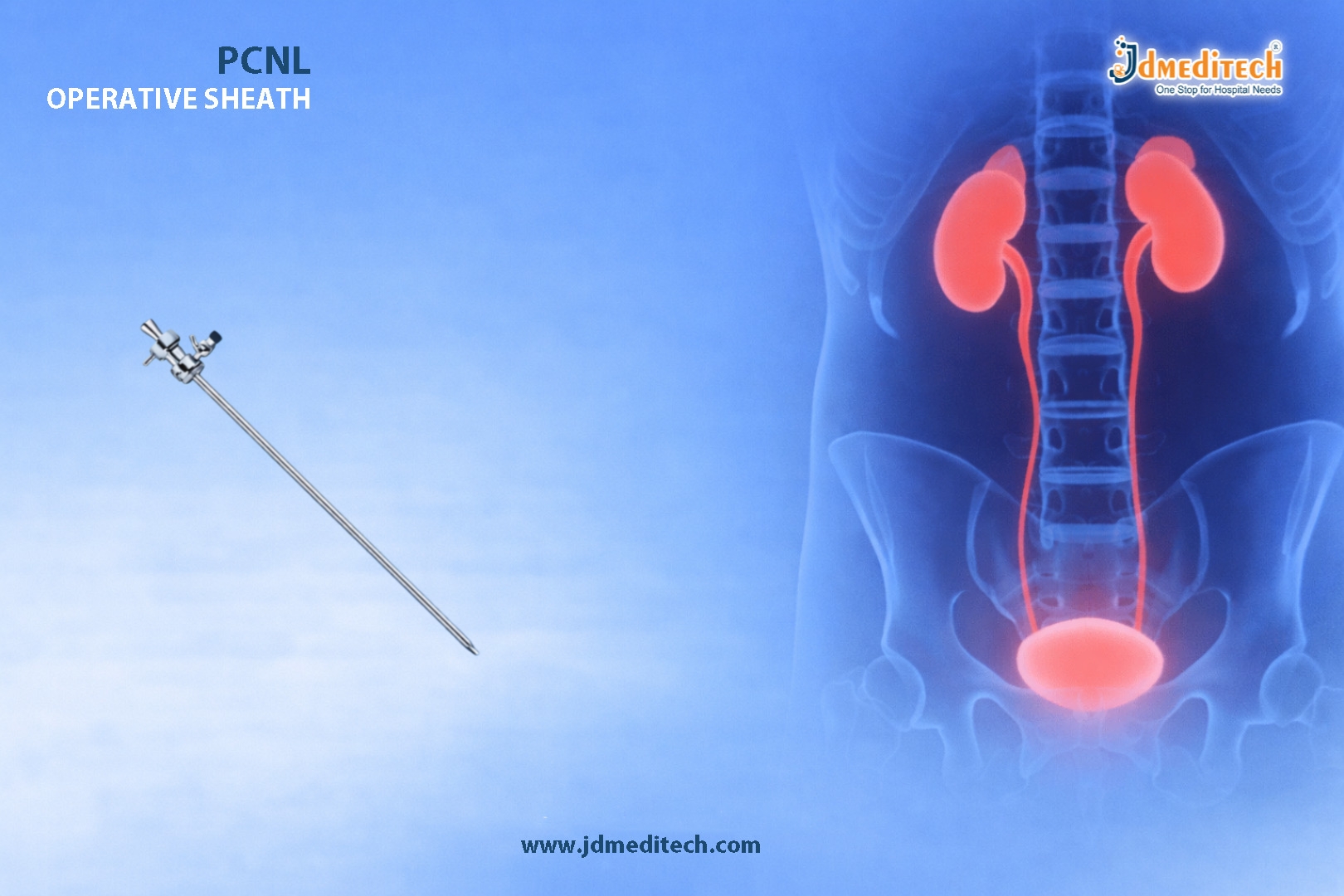 High-Quality PCNL Operative Sheath for Urology Procedures