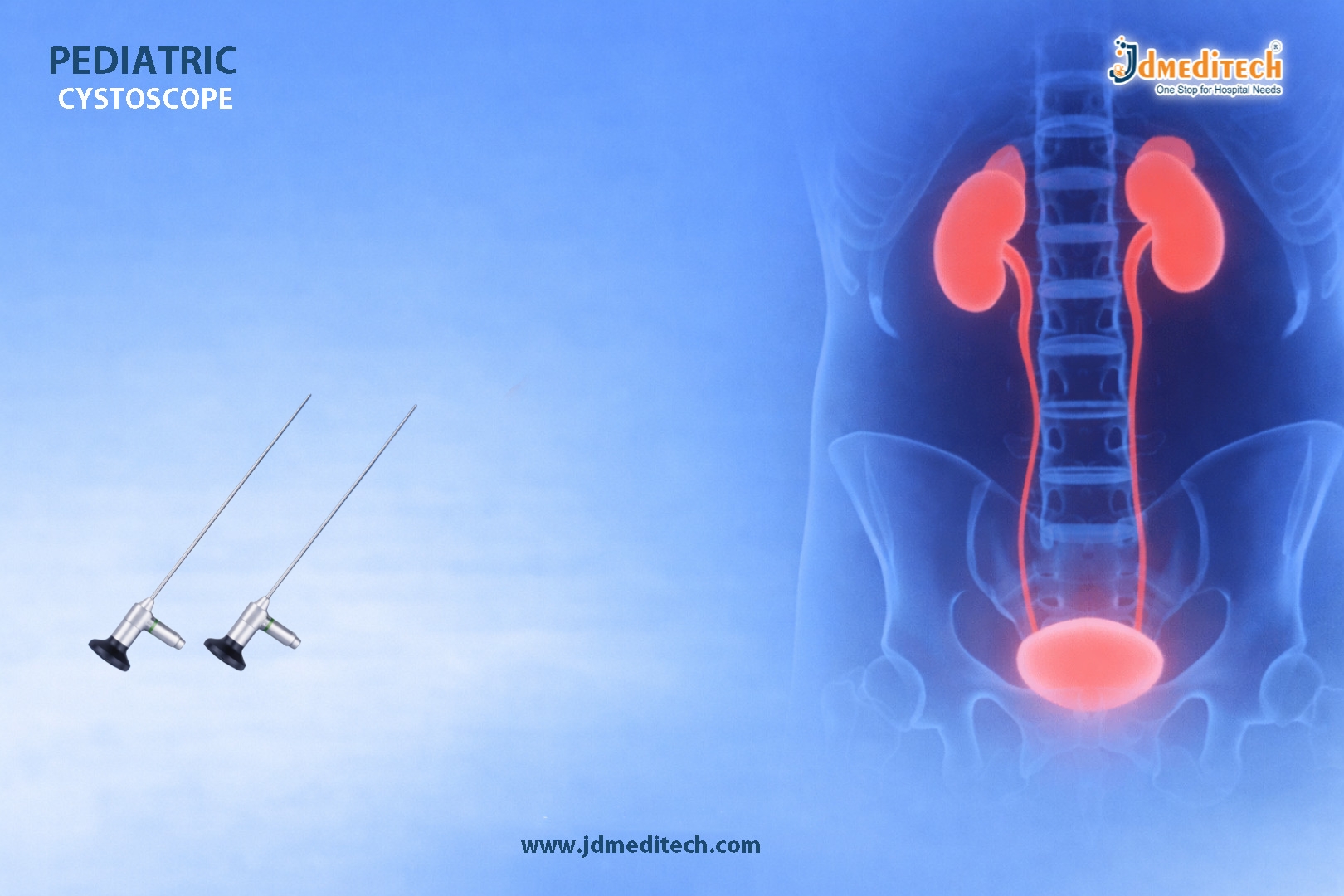 Pediatric Cystoscope – Precision Urology for Children