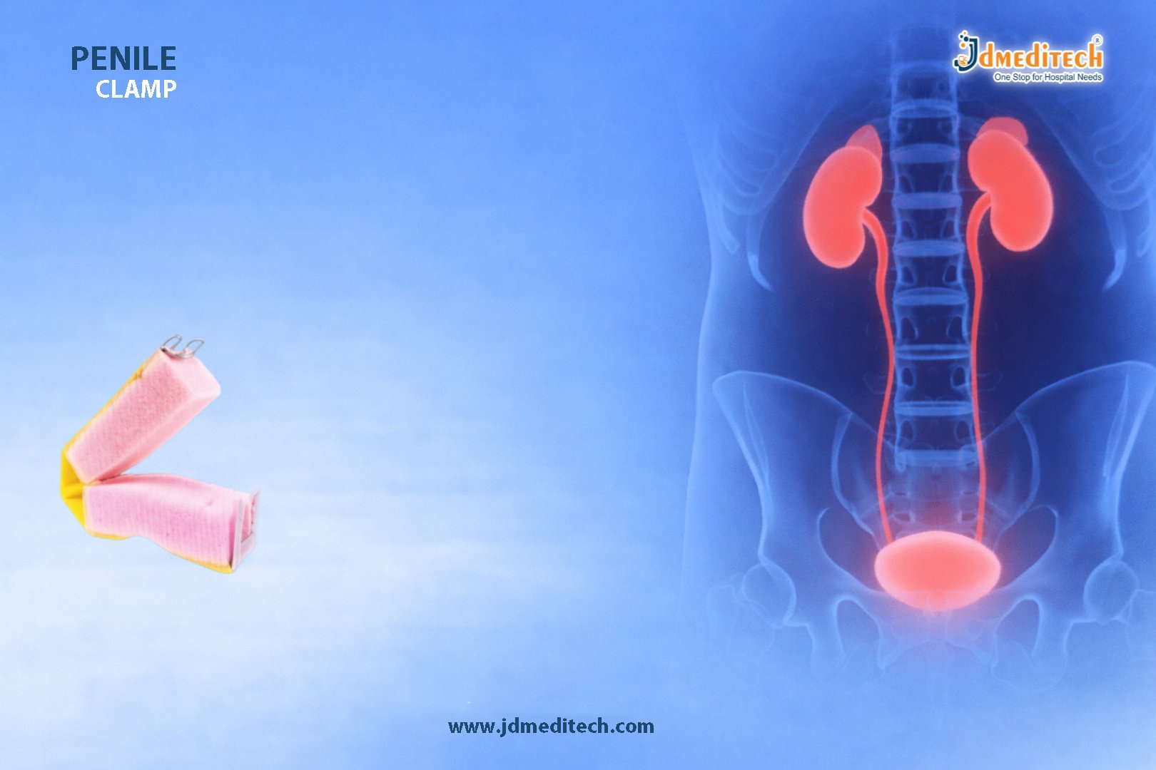 Penile Clamp – Effective Solution for Male Urinary Incontinence