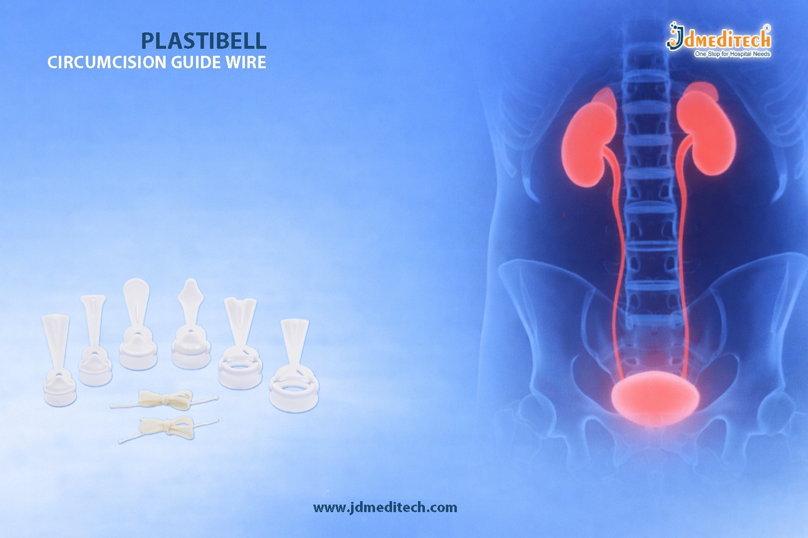 Plastibell Circumcision Device – Safe Infant Circumcision Solution