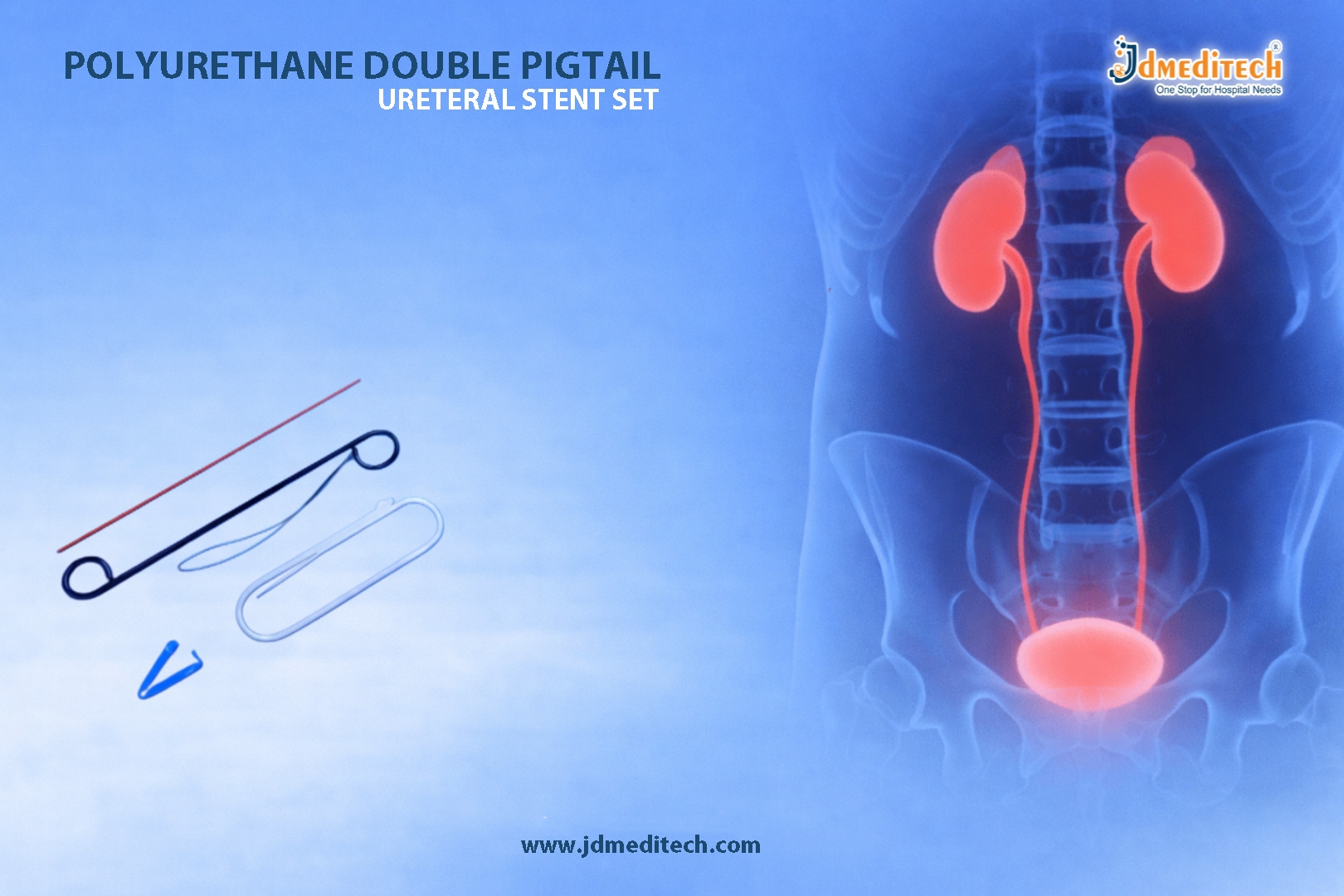 Polyurethane Double Pigtail Ureteral Stent Set