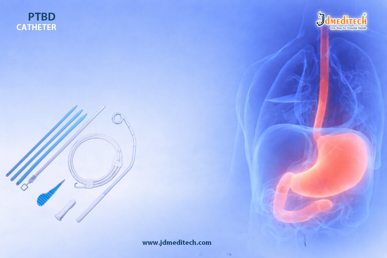 PTBD Catheter for Biliary Drainage – Safe & Effective Solution
