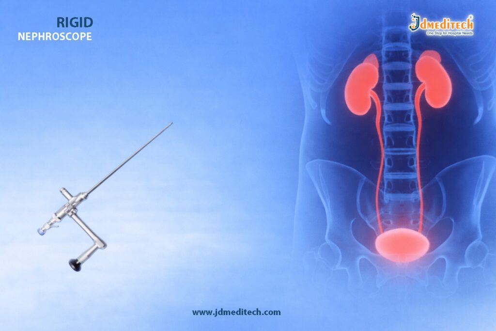 Precision Rigid Nephroscope – Optimized for PCNL Procedures