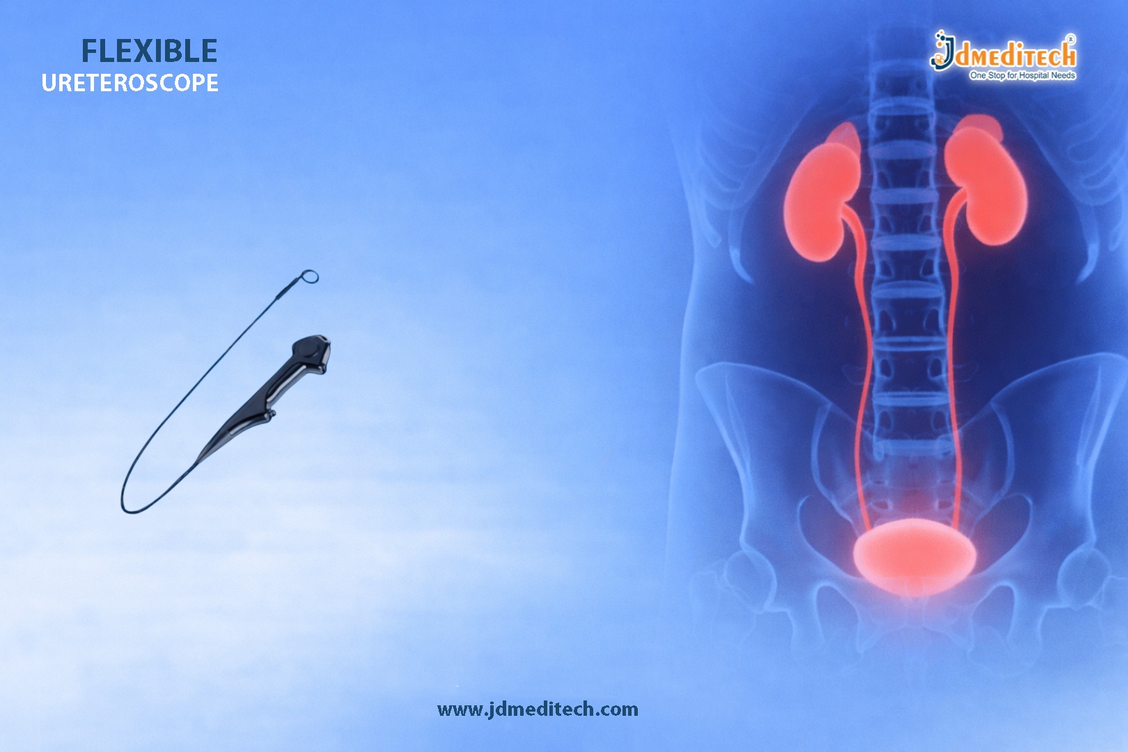 Flexible Ureteroscope – Precision, Flexibility & Clarity in Urology