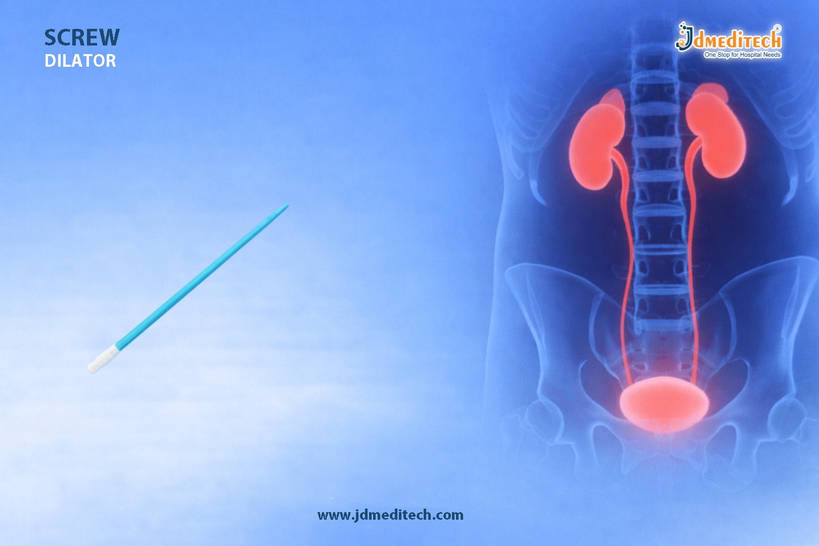 Screw Dilator for Urethral Dilation – Precision & Safety