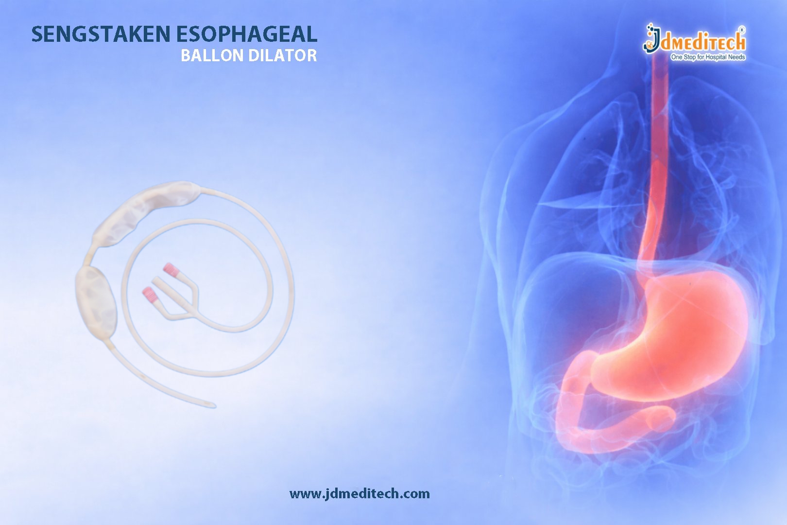 Sengstaken Esophageal Balloon Dilator for GI Bleeding
